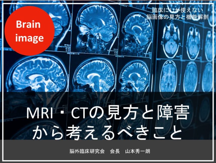 19年度第1回脳画像セミナーレポート 沖縄ver後編 脳外臨床研究会